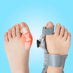 BunionFix™️ - Natural Bunion Corrector