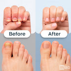Before and after comparison of nail and foot care with 'mLab' branding.